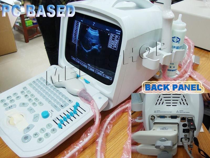   Portable Ultrasound Scanner/Machine 3 Probes+3D software Inside  